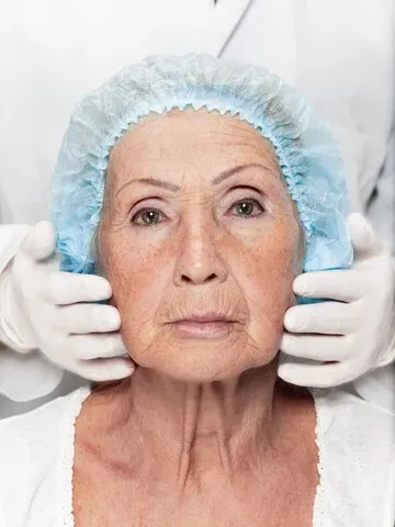Lipoenxertia Facial: entenda mais sobre o procedimento