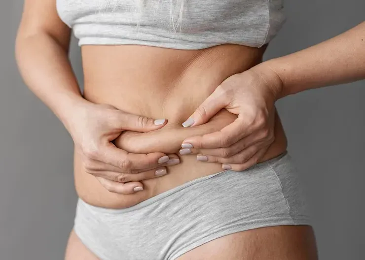 Mini Abdominoplastia: Quanto Custa, Como é Feita e Recuperação
