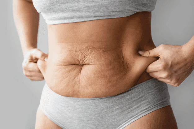 Abdominoplastia Pós-Bariátrica: Guia Completo