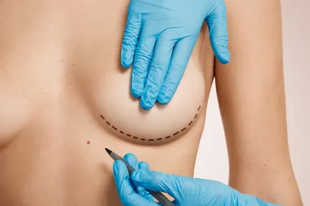Mamoplastia de Revisão: Compreendendo o Procedimento