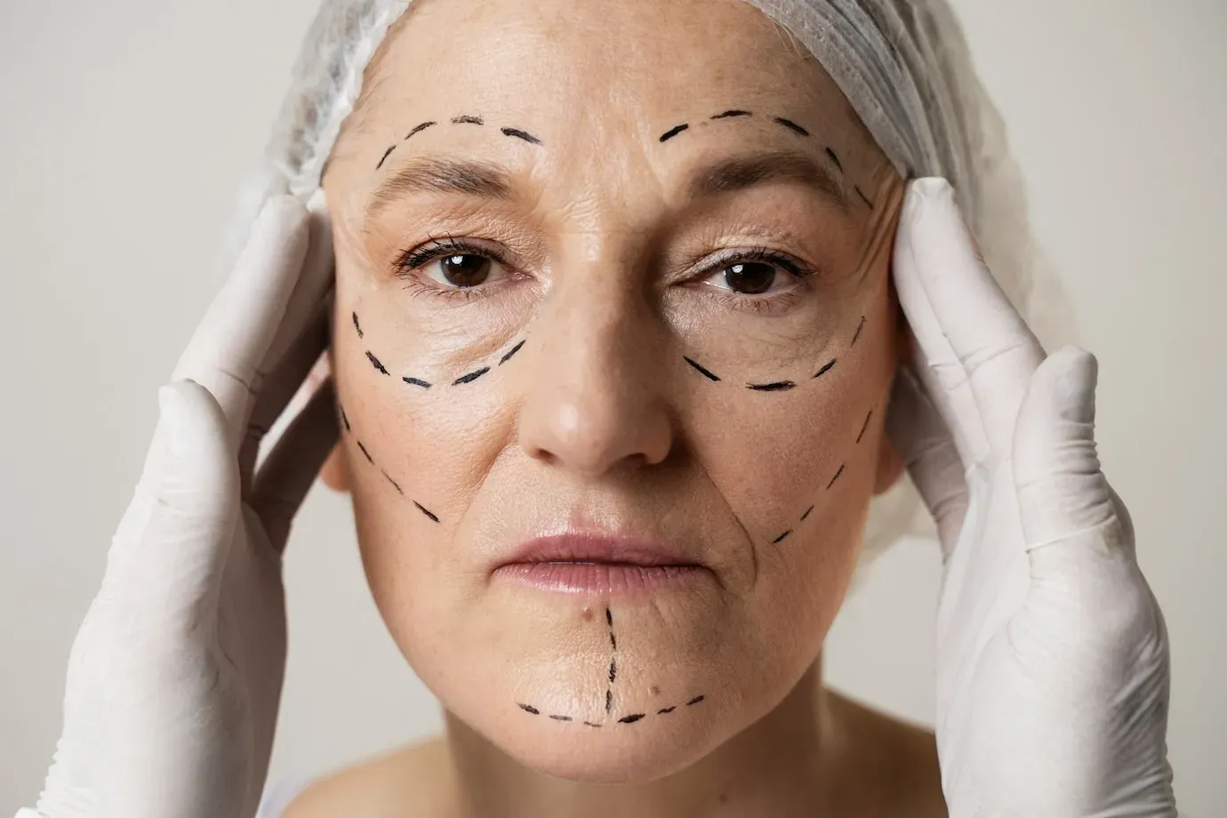Entenda mais sobre Harmonização Facial