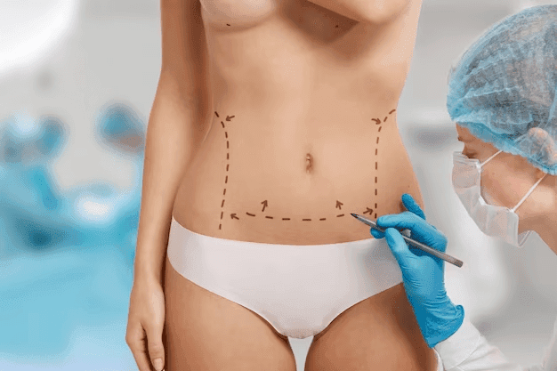 Quanto custa uma cirurgia plástica do abdômen?