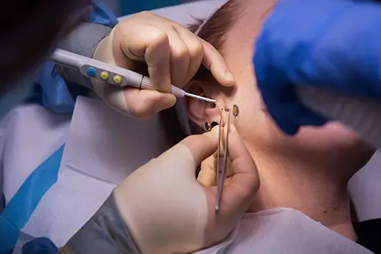 Tudo que você precisa saber sobre Pequenas Cirurgias Plásticas