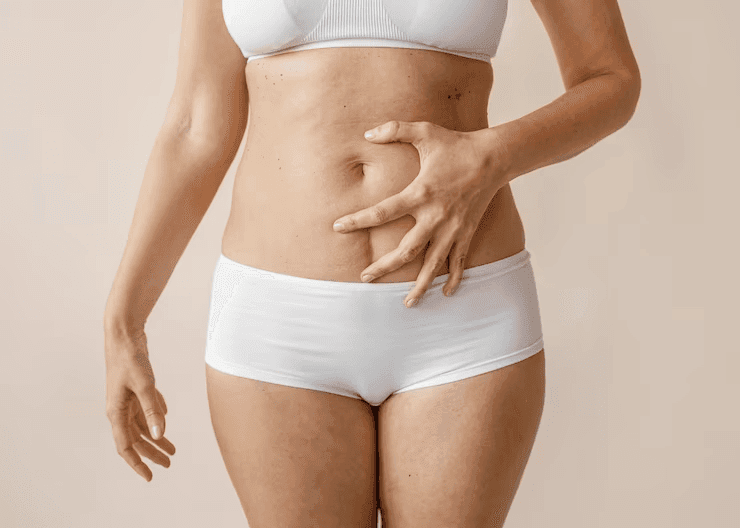 Onfaloplastia: cirurgia para correção do umbigo