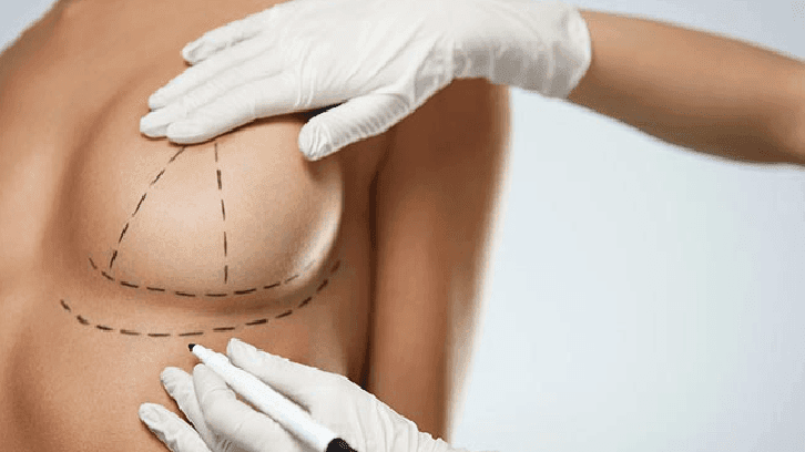 Mommy Makeover: a Cirurgia Plástica da Mamãe