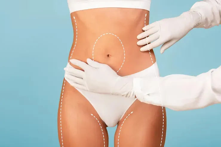 Mommy Makeover: a Cirurgia Plástica da Mamãe