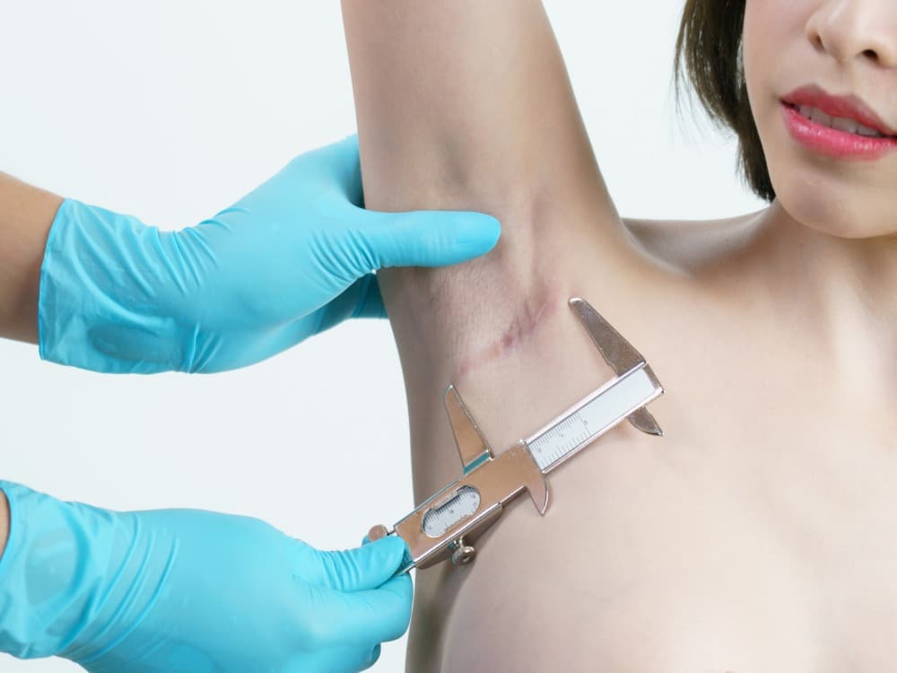 Riscos de uma Cirurgia Plástica