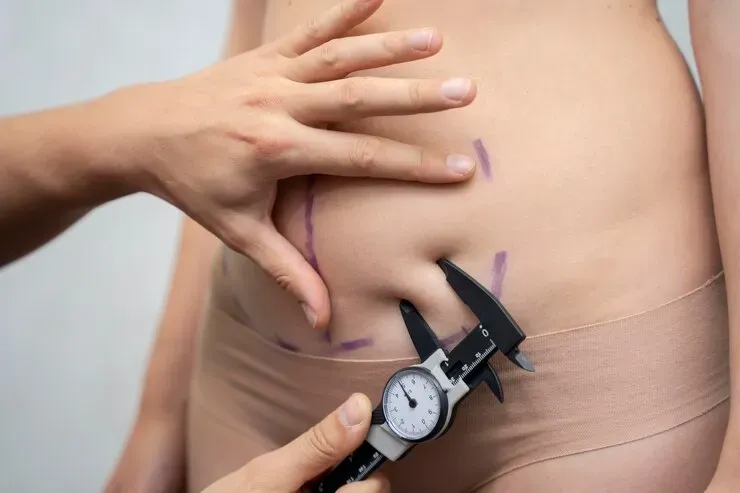 Saiba mais sobre Lipoaspiração