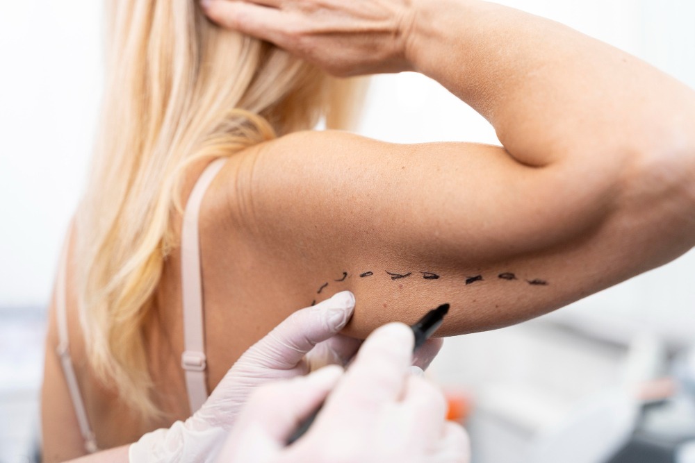 Braquioplastia Braquioplastia