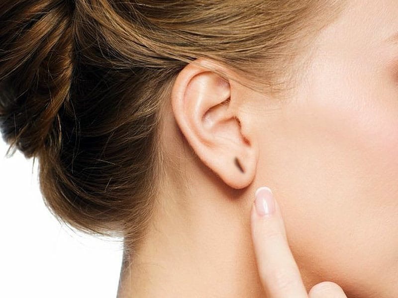 Quais cuidados pré-operatórios da Lobuloplastia?